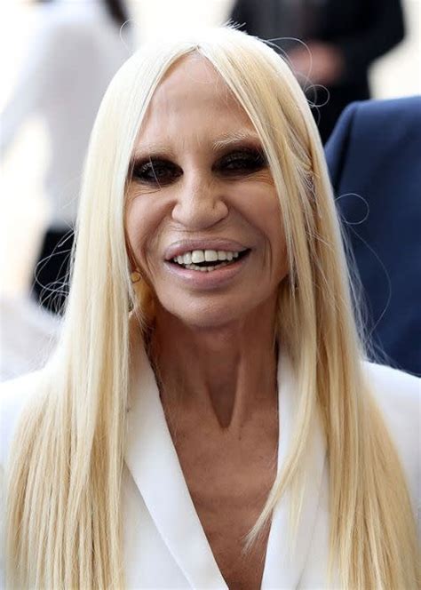 donatella versace young|what happened to donatella versace's face.